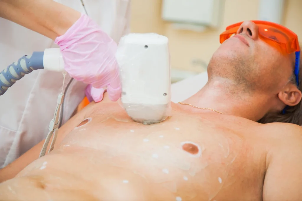 laser-brusthaarentfernung-muenchen.webp Laser Brusthaarentfernung München – Skinlaser Lucy